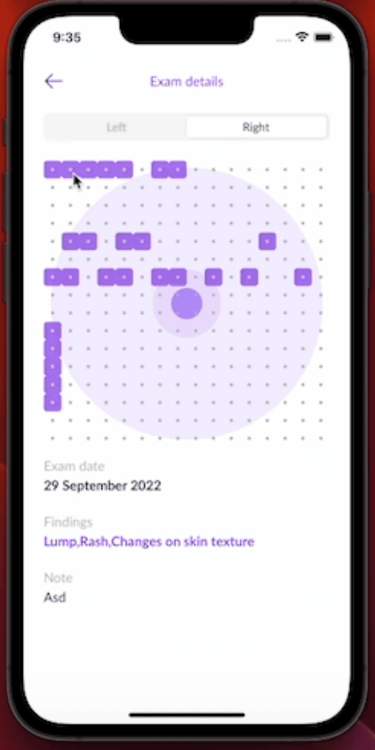 Triwi exam grid with multiple findings marked